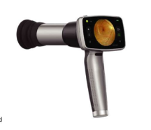 HFC-02 Portable Fundus Camera