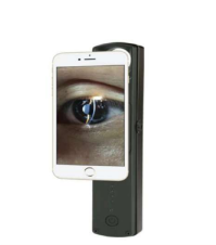 S-150Plus Portable Slit Lamp
