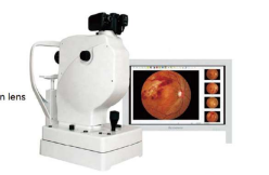 SK-650A Fundus Camera