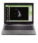 SP-2000 A/B Scan