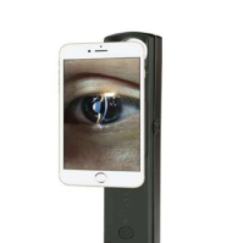 S-150Plus Portable Slit Lamp
