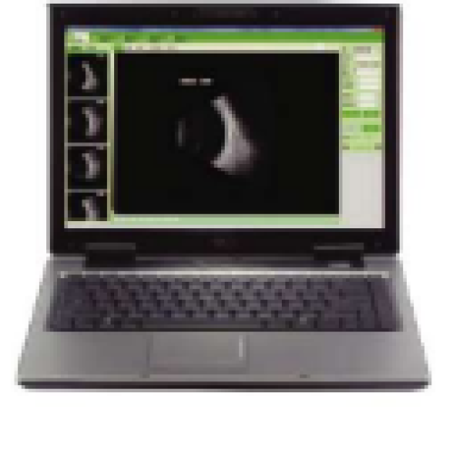 SP-2000 A/B Scan